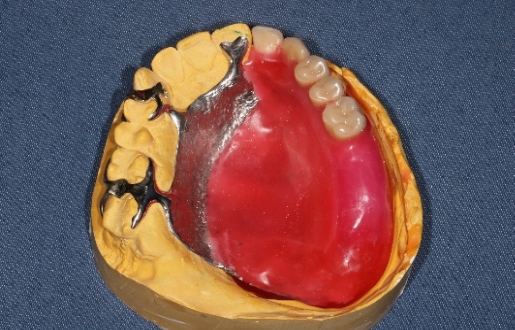 LARGE mt630814_200416- redigerad 2