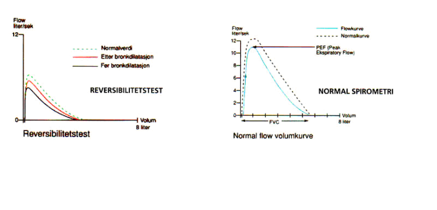 G:\Kansli\FS-Avdelningen\FAKTA\ÖFaktasidor från plussidorna 2022\Lungor och allergi\Spirometrikurvor_bild.bmp