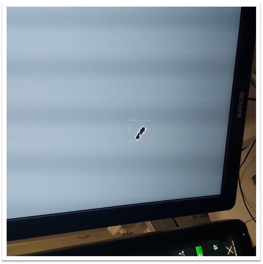 G:\RYH\Sjukfys\1_Ny_struktur\Röntgen\Projektarbete\DosestatQC\MG\DFK\Del2\under utvärdeing av ny analys\Labb 65 bild 3.jpg